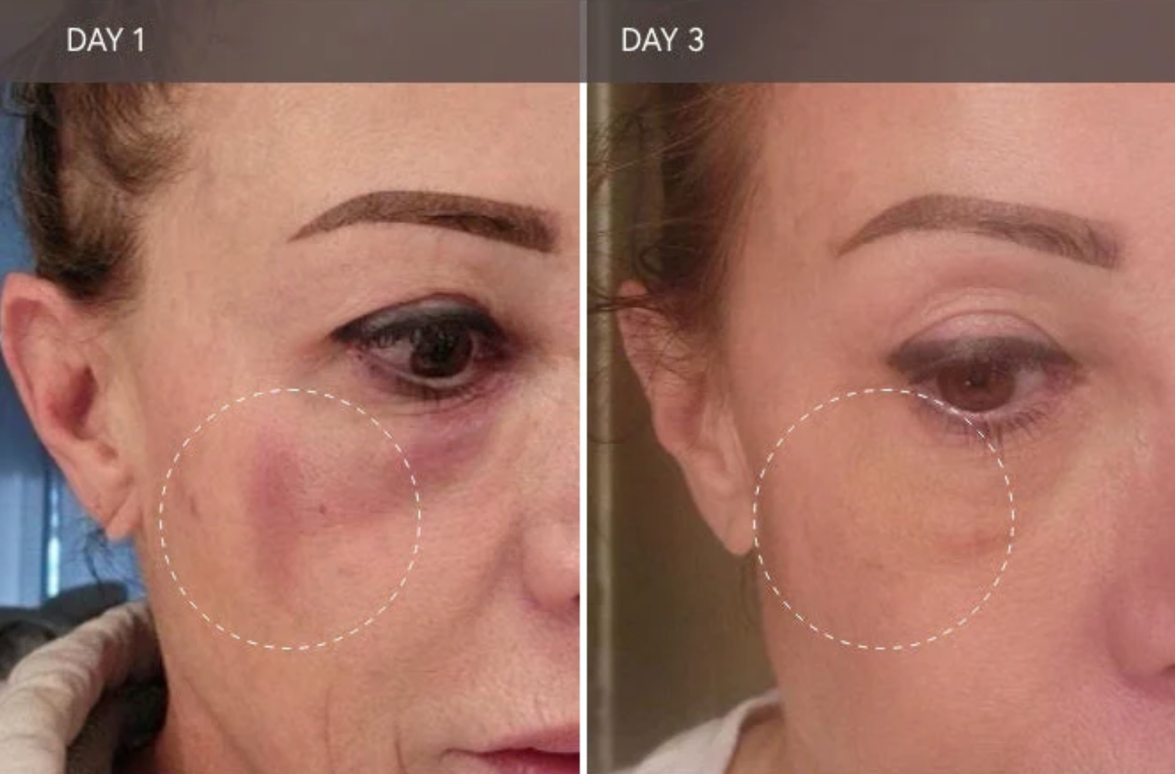 Viktor Michael Ciao For Now™ Post Injection Care Mask (1.7 fl oz / 50mL)